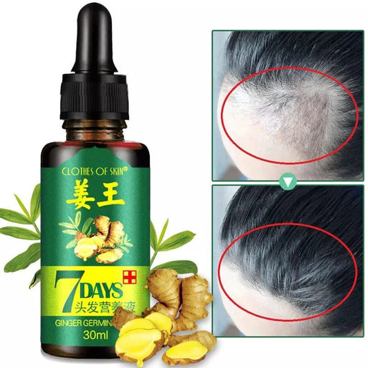 7 Days Ginger Germinal Oil for Hair Regrowth | Martigo Store